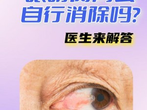 超级胬肉系统【什么是超级胬肉系统？它有哪些独特之处？】