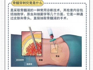 人体造血工厂的核心：骨髓的奥秘与功能揭秘