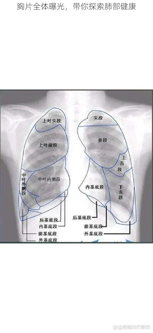 胸片全体曝光，带你探索肺部健康