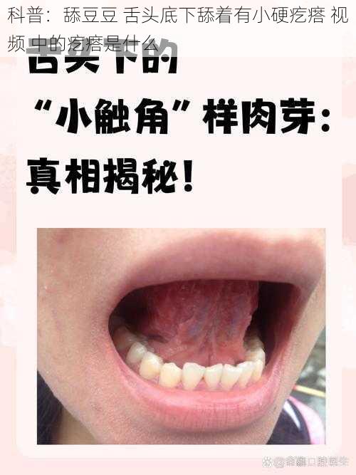 科普：舔豆豆 舌头底下舔着有小硬疙瘩 视频 中的疙瘩是什么